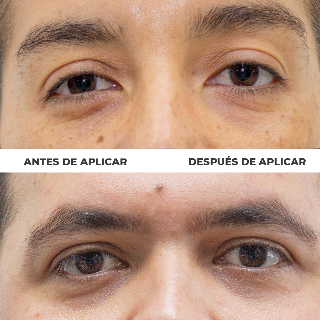 Serum Suspensión Reafirmante